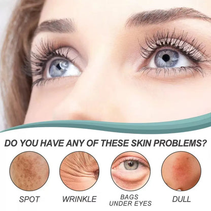 Dark Spot Corrector-Special Cream For Melasma Treatment