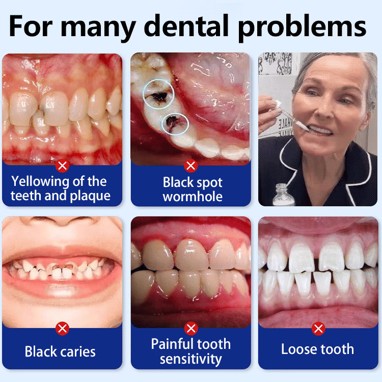 🔥Fluoride-Free Hydroxyapatite Tooth Armor Drops Enamel Repair, Whitening & Fresh Breath Gentle Oral Care