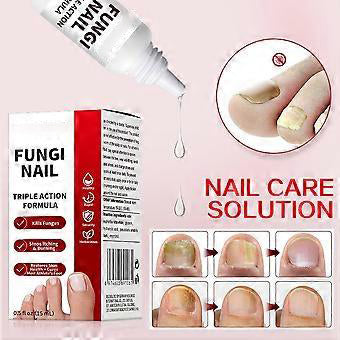 Nail Care Renewal for Thick, Damaged & Discolored Nails, Plant Based Formula for Healthy Nail and Skin - 0.5 Fl Oz