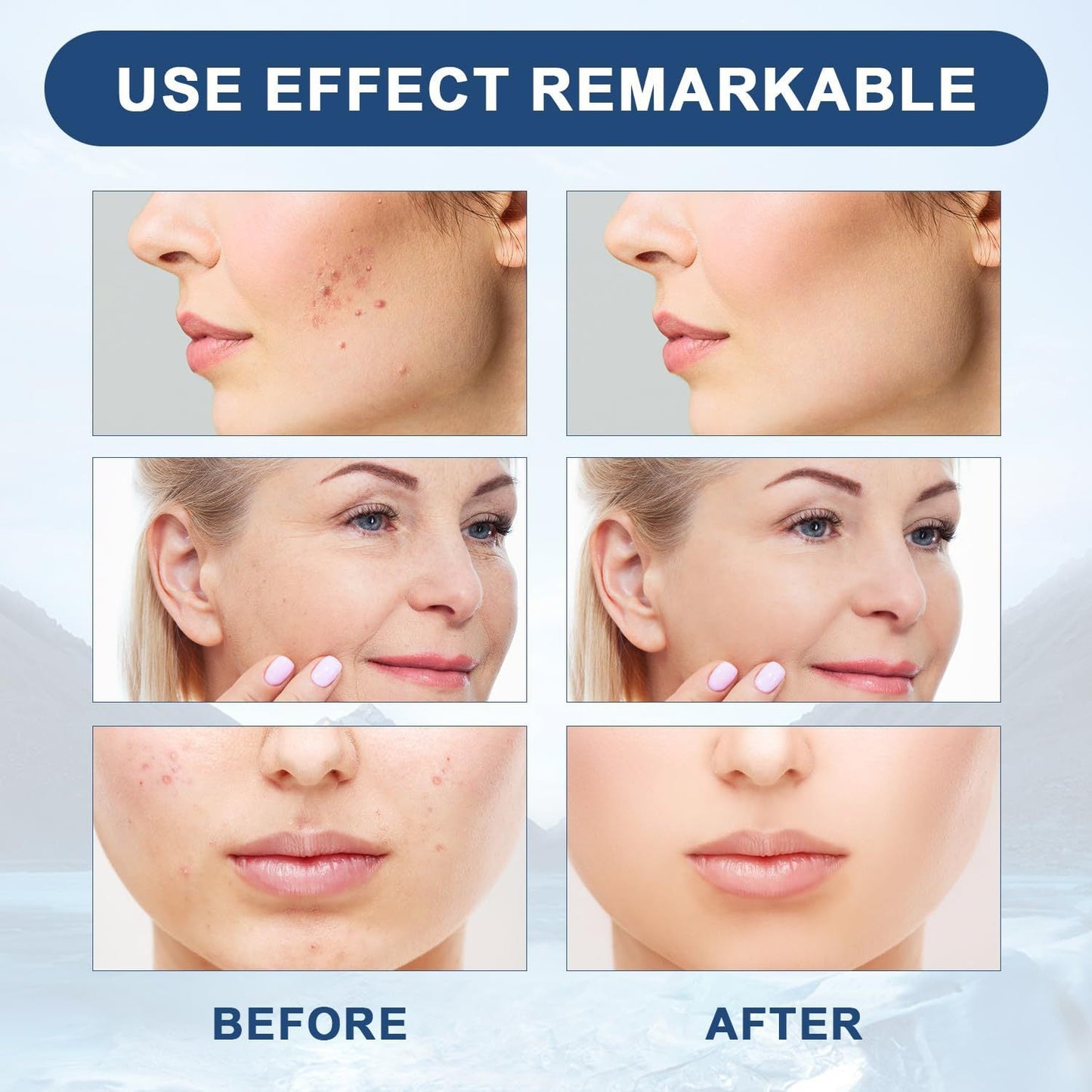 VICI WRINKLE REMOVAL OIL