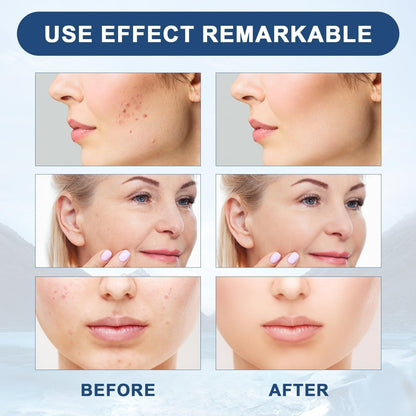 VICI WRINKLE REMOVAL OIL