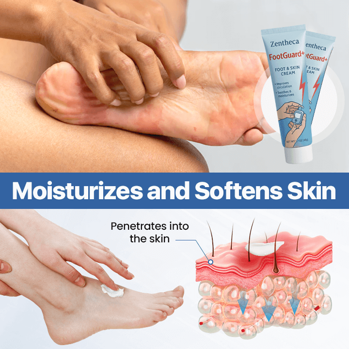 FootGuard+ | Diabetes Treatment Cream